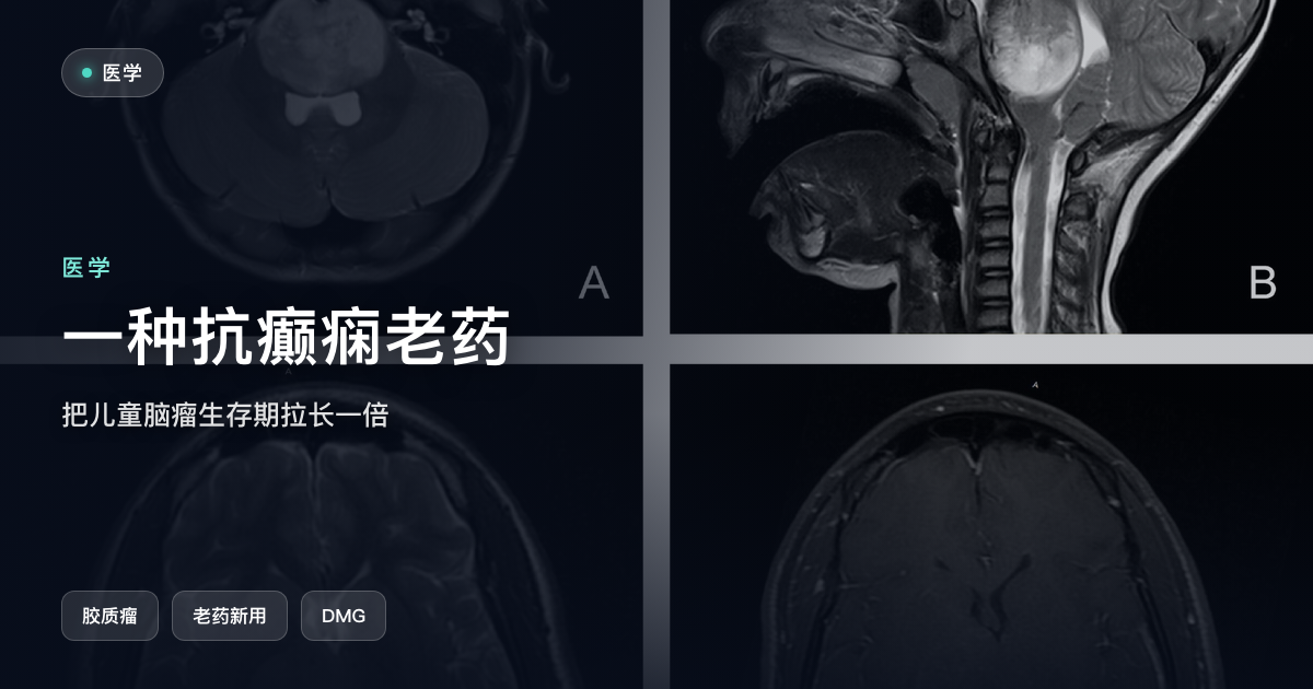 一种抗癫痫老药,把儿童脑瘤的生存期拉长了一倍